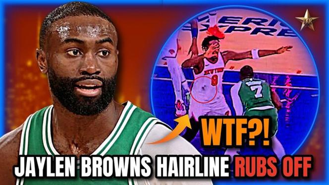 茂密头顶不是梦！多家植发机构联系杰伦-布朗！